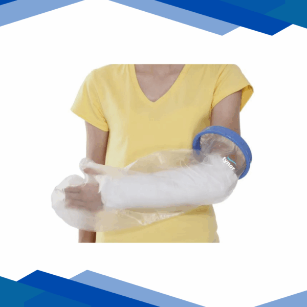Cast-Cover-Arm